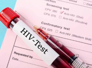 Does Anal Sex Cause HIV?