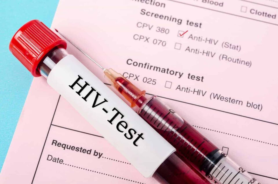 Does Anal Sex Cause HIV?