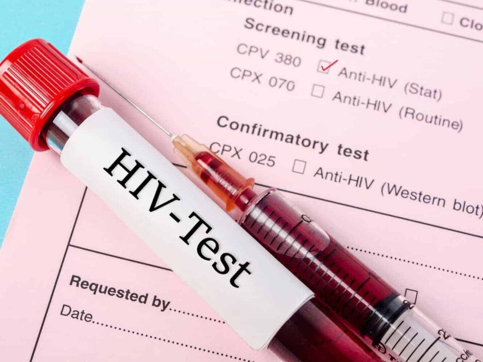 Does Anal Sex Cause HIV?