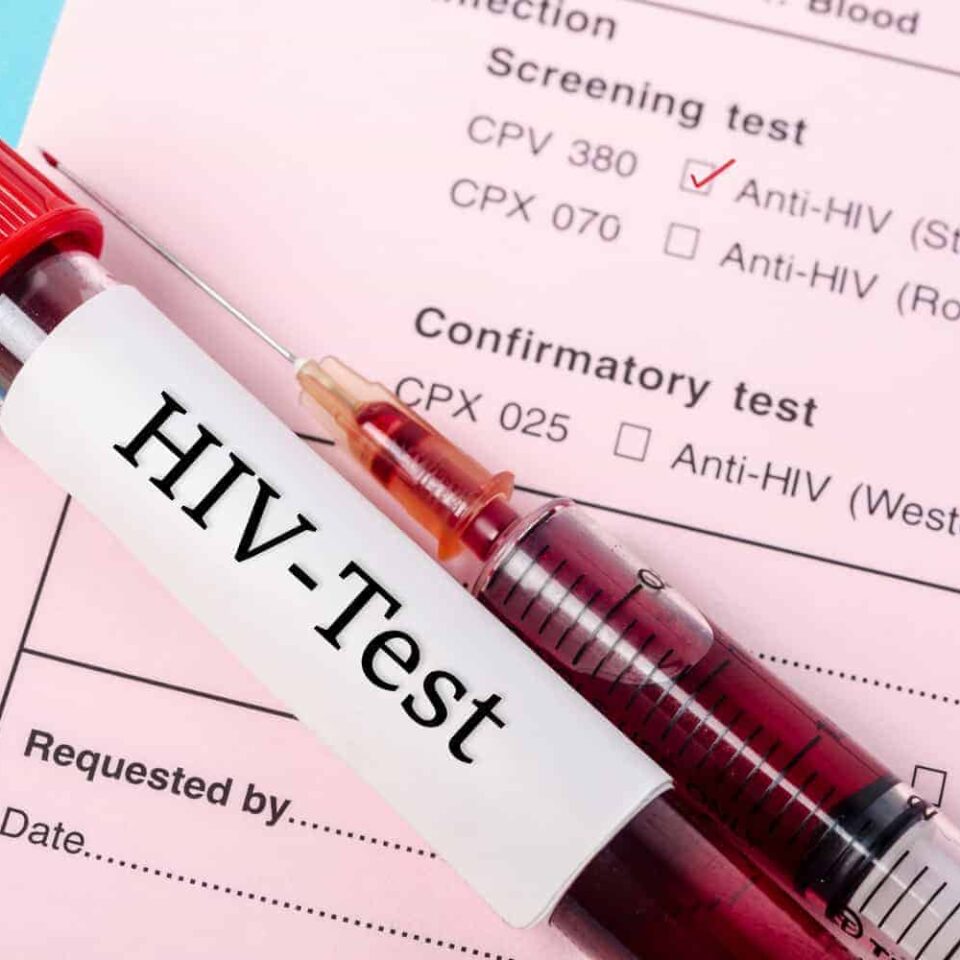 Does Anal Sex Cause HIV?